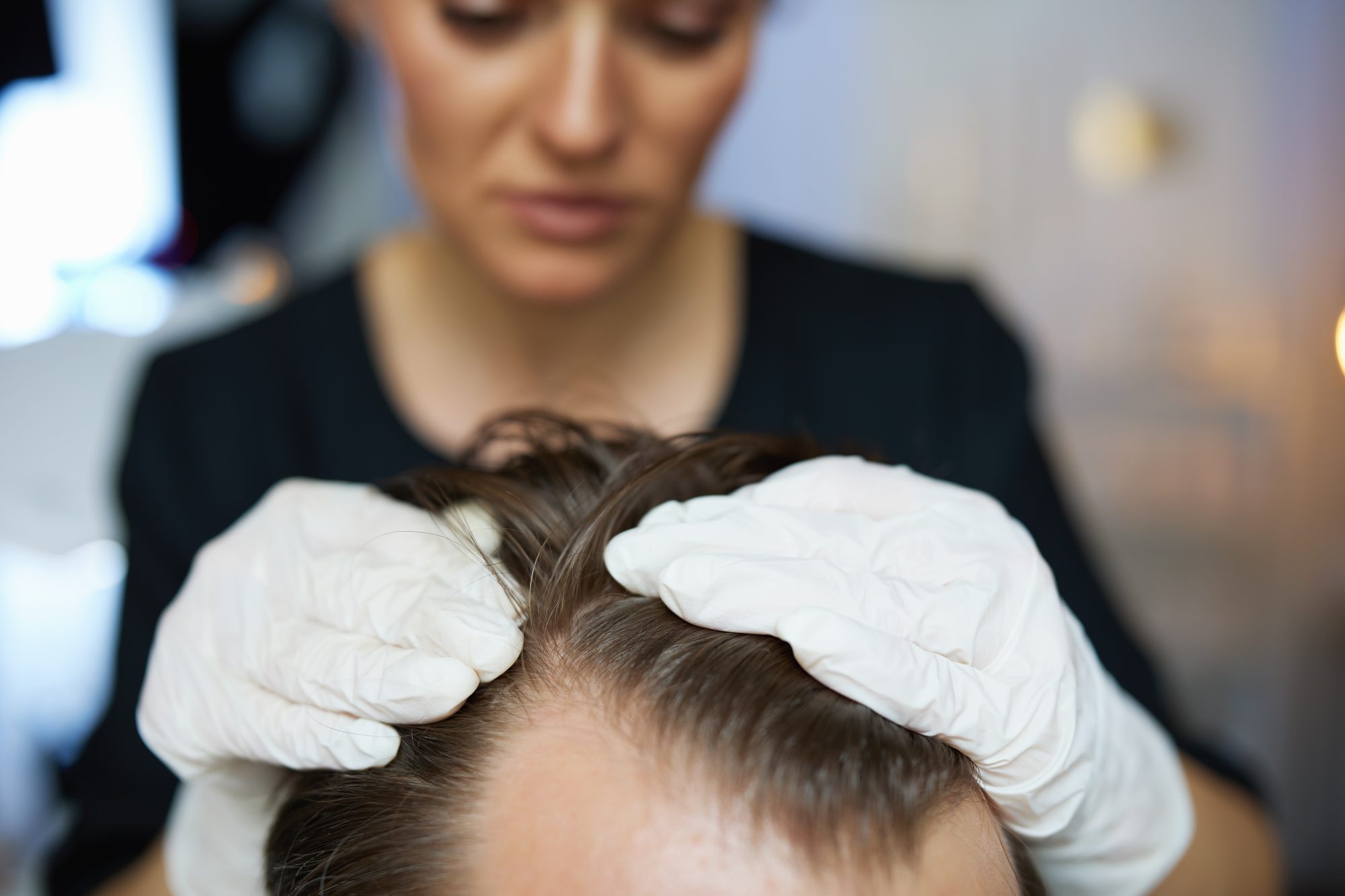 Tricología en Medicina Estética